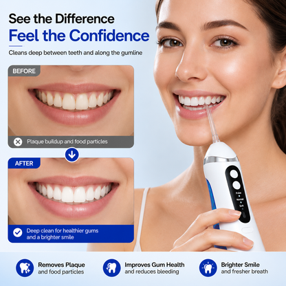 AquaSmile Pro – 3 Mode Oral Irrigator